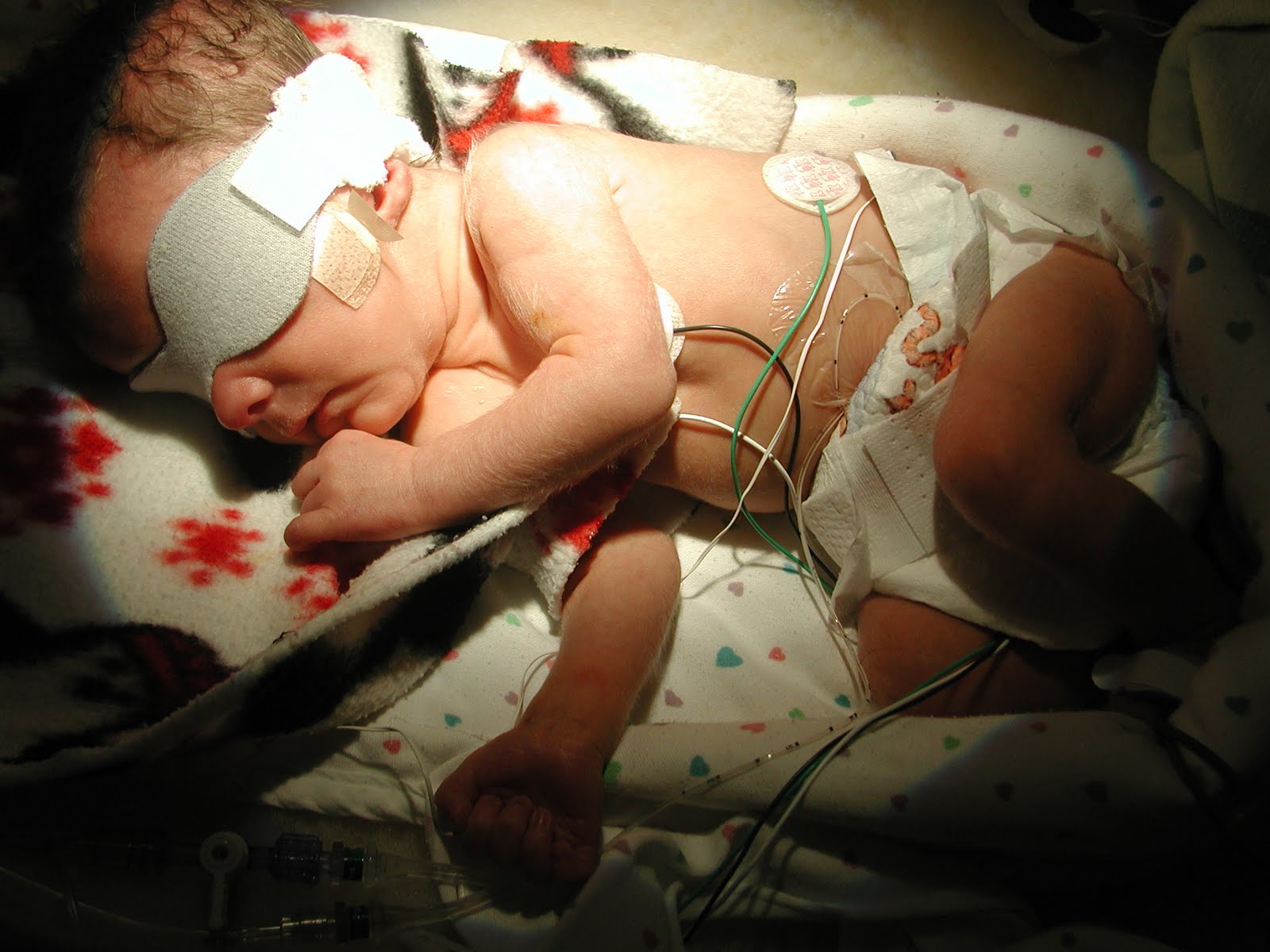 How long does Ulram withdrawl's last - Addiction & Recovery.