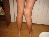 Rear View - Old Knee