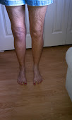 Front View - New Knee