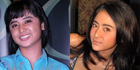 Dewi Perssik, efore and after thermage before after. Dewi Perssik, efore and after