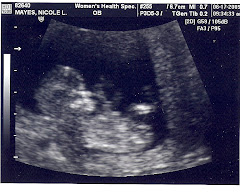 Baby's first picture!