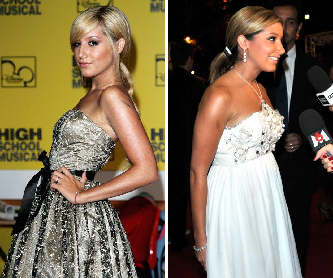 http://2.bp.blogspot.com/_PjILj76JuJQ/SOP5olsywHI/AAAAAAAAEvQ/viT9-wQU4Pk/s1600/ashley-tisdale-nose-job1.jpg