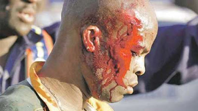 un muerto y diez heridos en partido amistoso sudafrica 2010