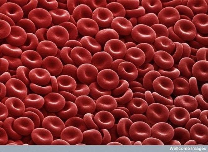 Bad Blood Cells