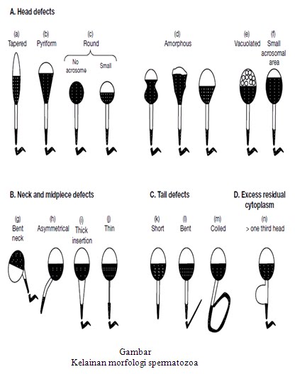 xxx pics - Critique of evolutionary biology sperm wars of wars biology Critique evolutionary sperm