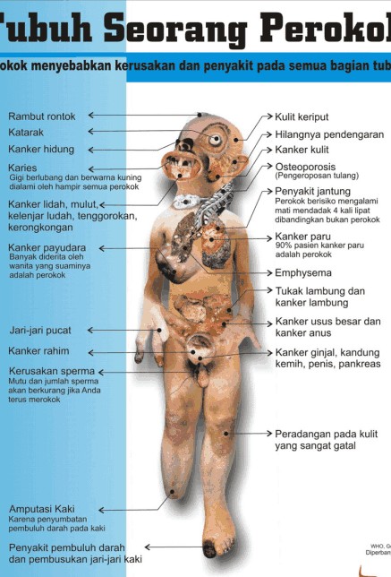 http://2.bp.blogspot.com/_QOodpxWtMaQ/S8sVT3rF6eI/AAAAAAAAAAM/Wyk1PaXoDCw/s1600/bahaya-merokok3.jpg