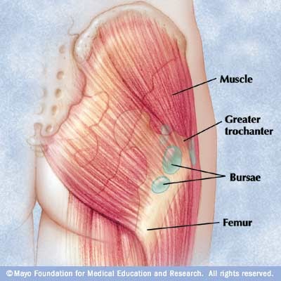 Thoughts of an Experienced Sports Physical Therapist: Hip Pain Due To