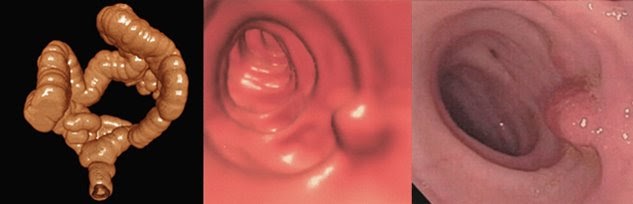 Pharos Review Medicare CT Colonography Not Ready For