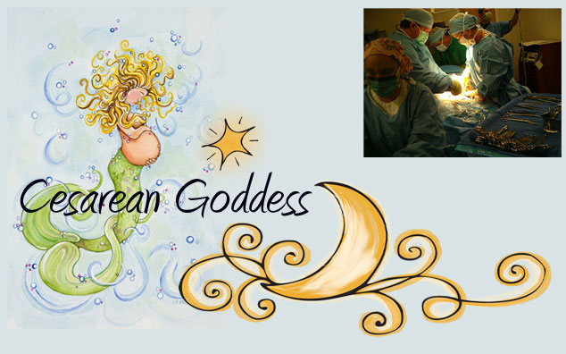 Cesarean Stitches