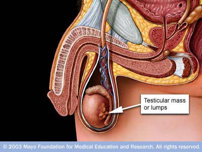 Testicular cancer ribbons