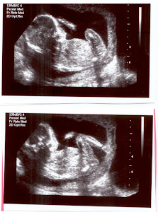 19 week ultrasound