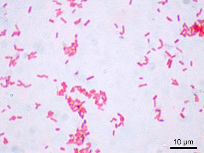 staphylococcus aureus gram stain. cocci andin a gram stain