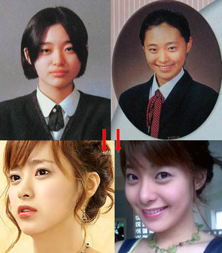 SARANGHAE BLOG♥♥♥: KOREAN ARTIST VS PLASTIC SURGERY...BUT FANS ...