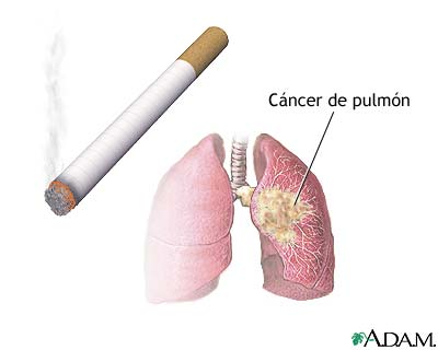 Como Afectan Las Sustancias Quimicas Del Tabaco A La Salud