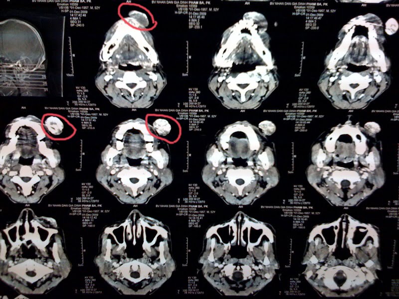 Brain+ct+scan+images