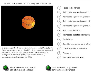 Simulador de examen de fondo de ojo