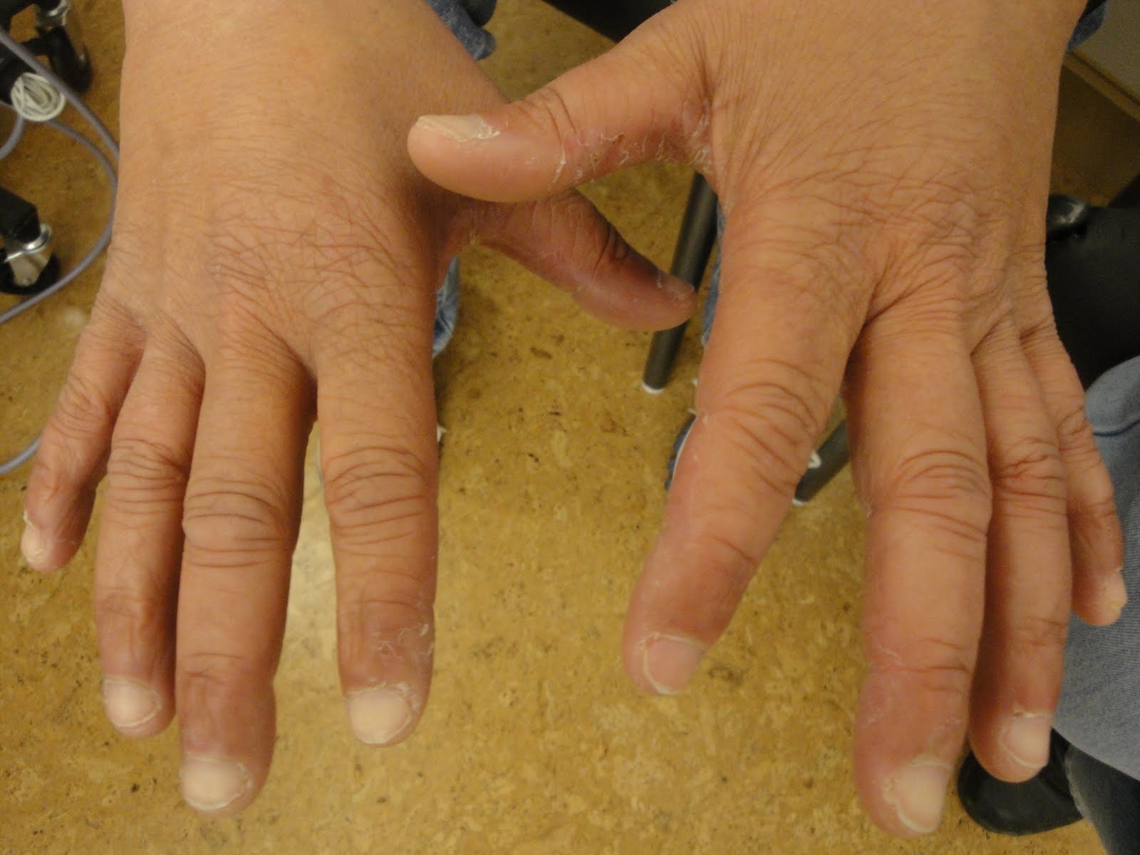 VIRTUAL GRAND ROUNDS IN DERMATOLOGY 2.0 September 2010