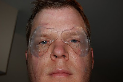 'lasik-eye-surgery-risks