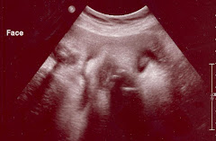 Ultrasound 3/26/09