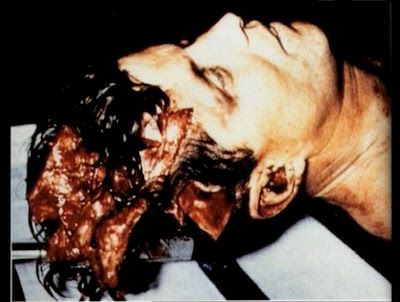 Jfk Autopsy Video - Page 2 kennedy autopsy pictures. Jfk Autopsy Video - Page 2