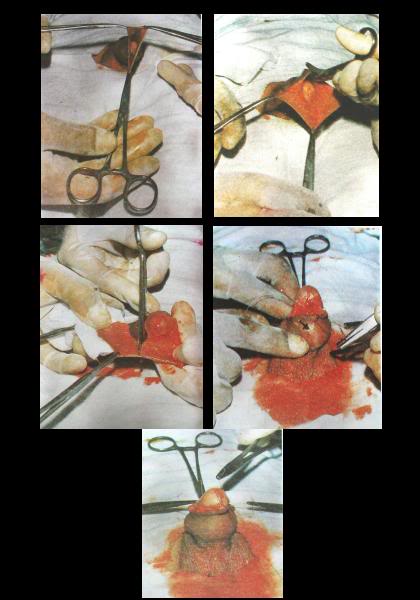 Sunat, Perlu atau Tidak sih? | Laki-laki Biasa