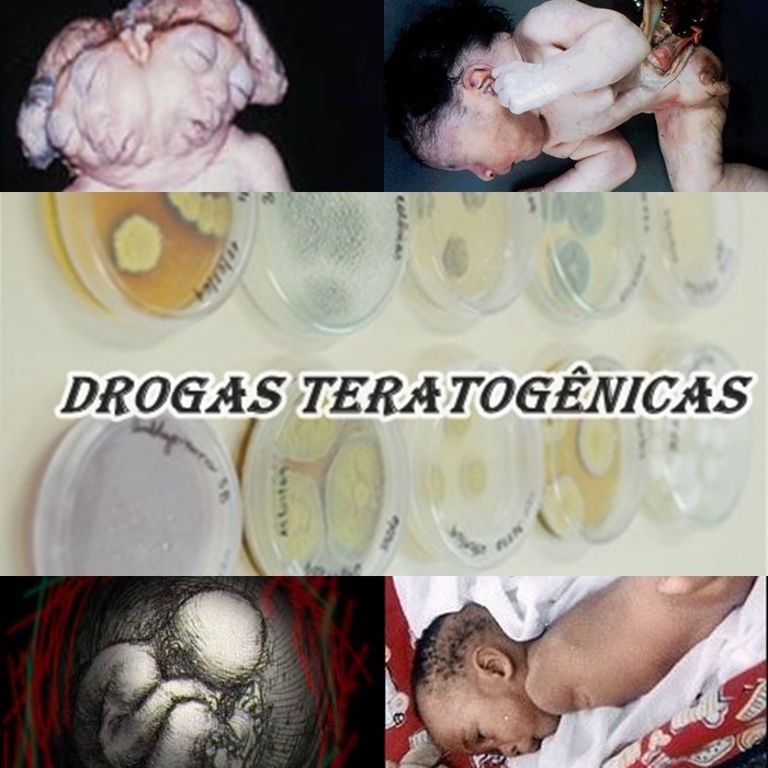 Drogas teratogenicas
