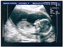 2nd Ultrasound Picture