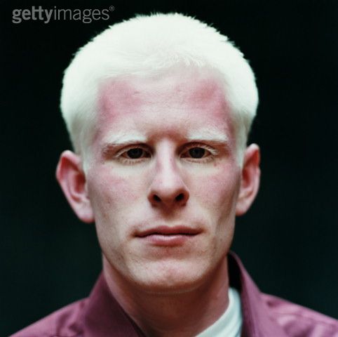 albino.jpg