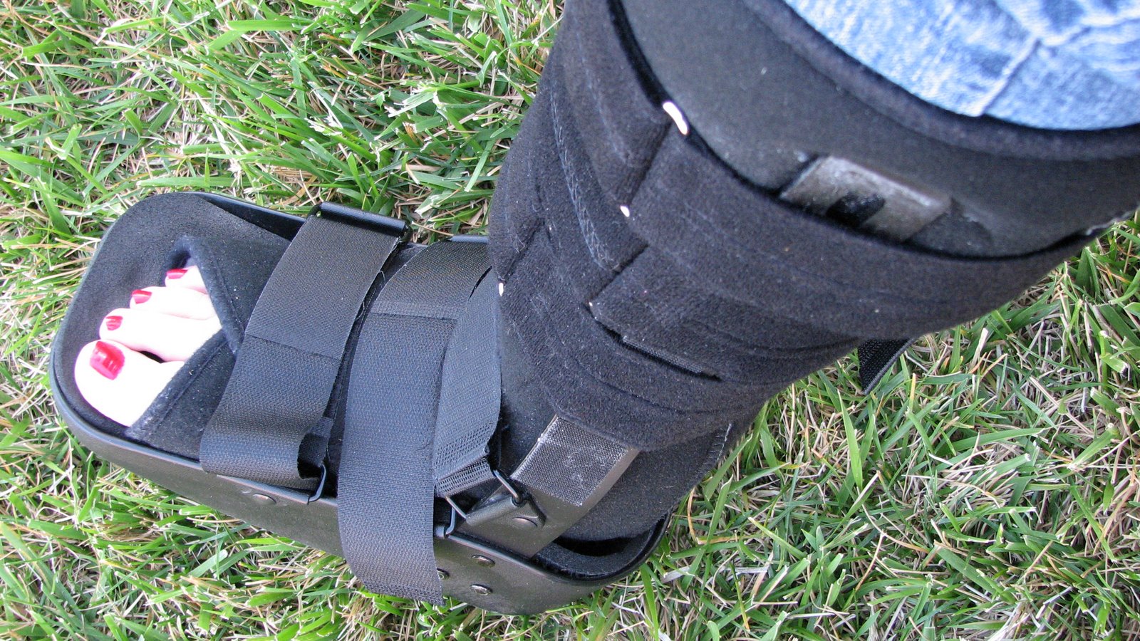 [bionic+leg.JPG]