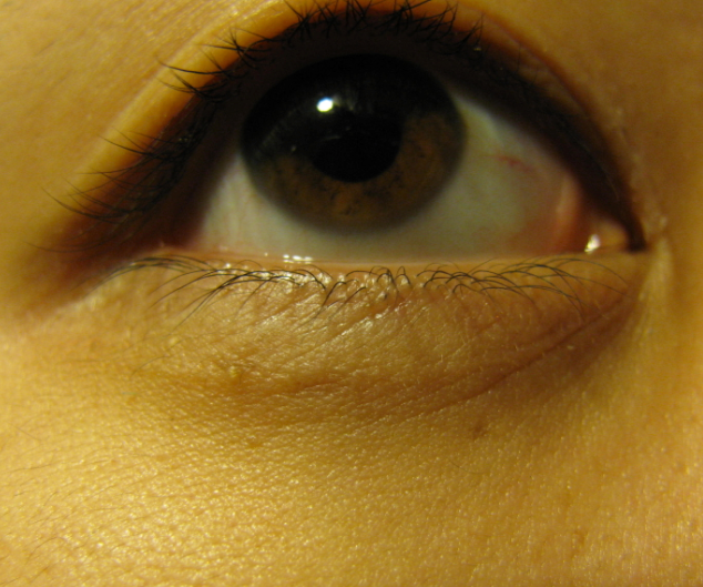 How to Conceal Under eye circles bubbles and beauty