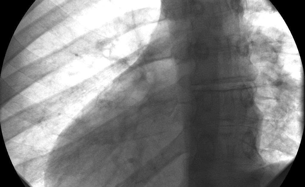 Rob's Radiology Situs Inversus Case 1 6/7/2009