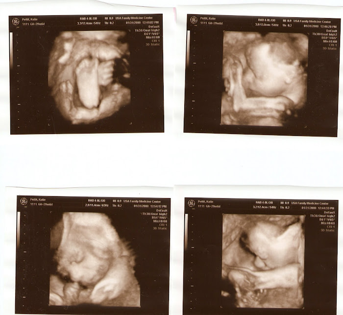 Cooper Ultrasounds