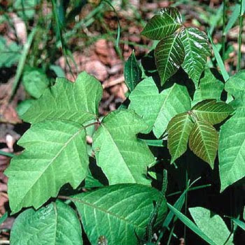 Poison ivy treated with steroids