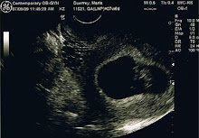 Baby Querrey