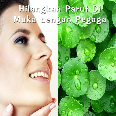 Image Result For Petua Hilangkan Panau Image Result For Petua Hilangkan Panau