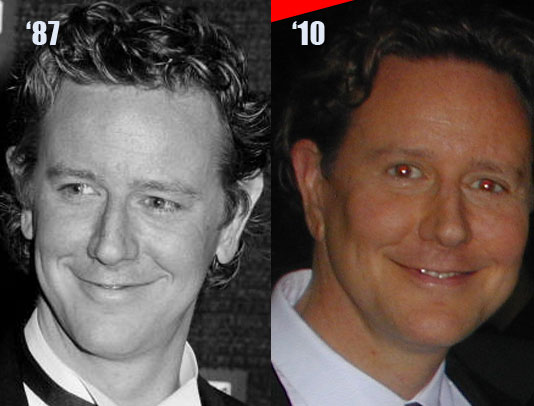 Judge Reinhold Before And After. 