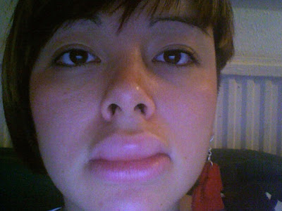 heat rash on aby face. heat teething rash on face pictures. heat rash on aby face. heat