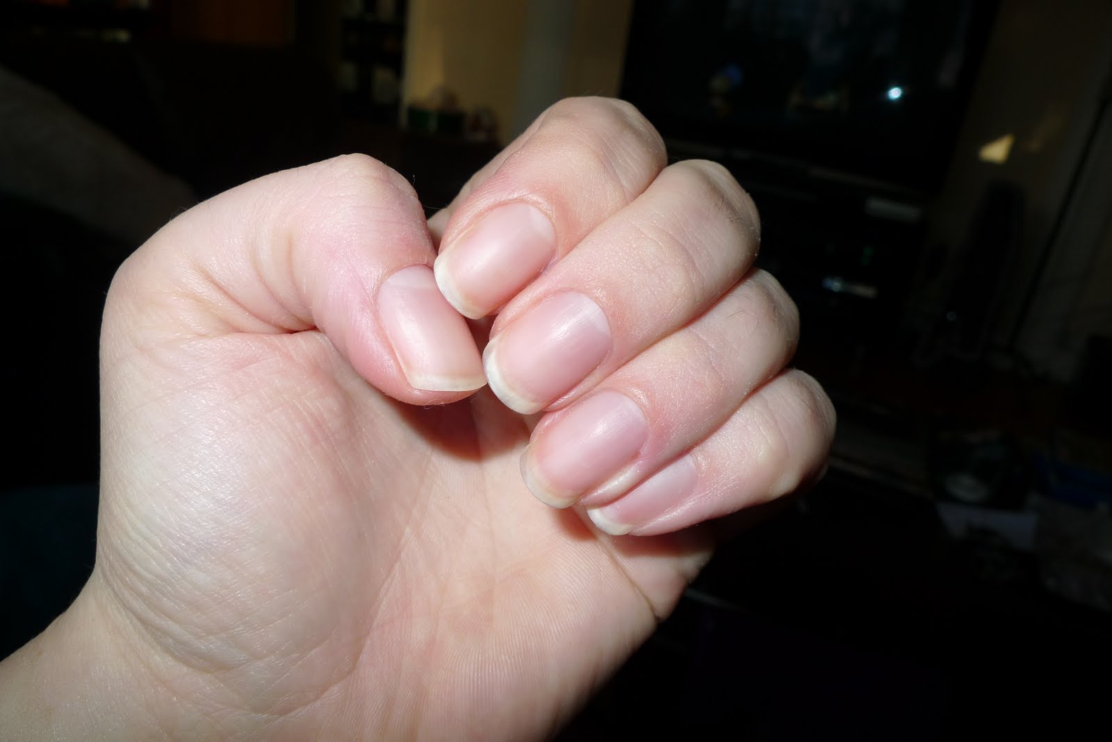 kittys claws Yellow stained nails