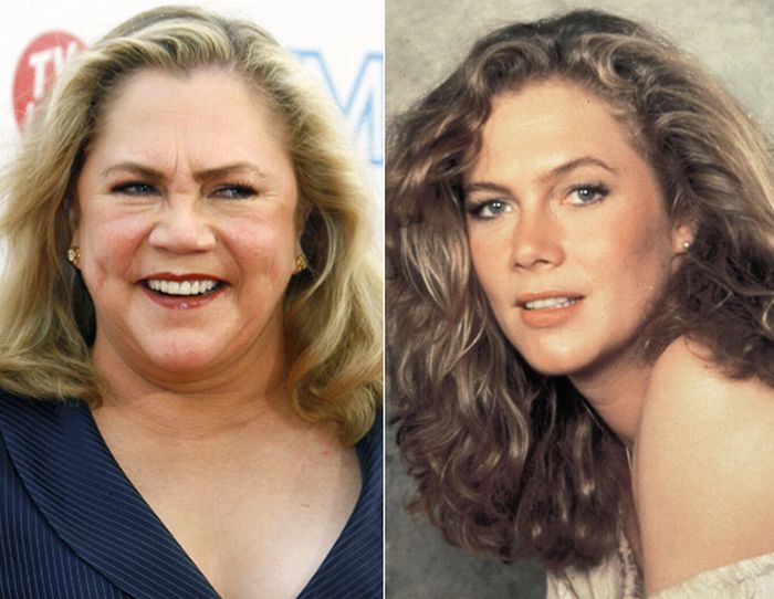 I don't know what the hell happened to Kathleen Turner but I think she's 