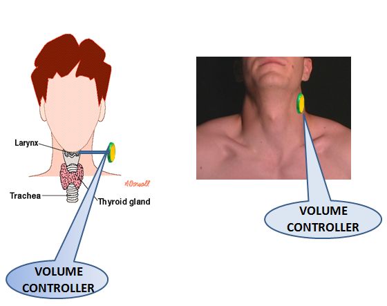 [VOLUME+CONTROLLER.JPG]