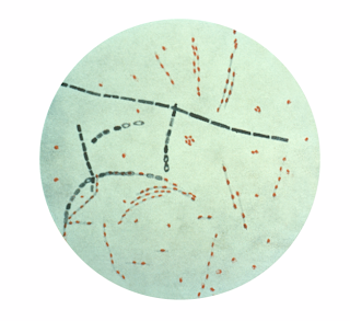 Bacillus anthracis spores, This image comes from the US federal government's Centers for Disease Control PHIL