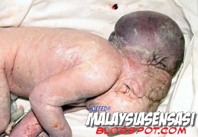 Artikel Tentang Dadah