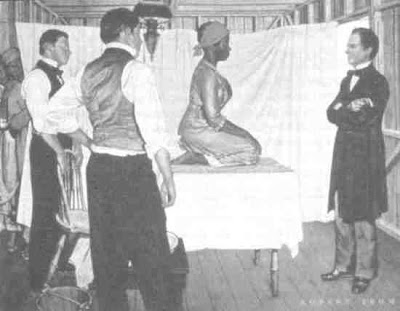 One of Sims' patients, the enslaved Anarcha Westcott, got through 30 operations without anesthesia due to popular belief that black people felt no pain. 