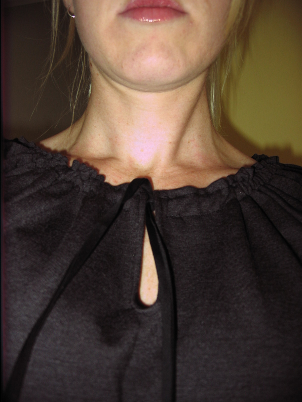 Little Bean How to Make a Keyhole Neckline