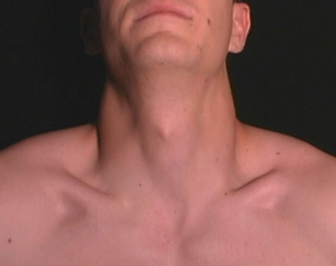 neck photos