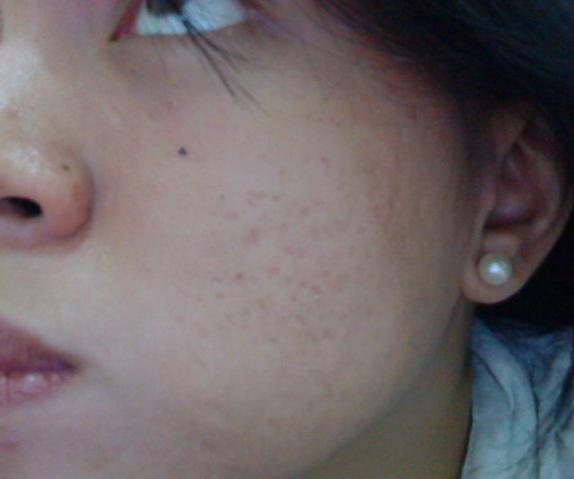 [mycheek.JPG]