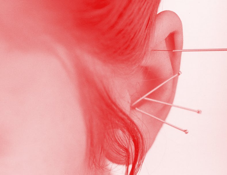 [ear2.bmp]