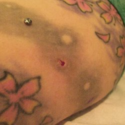 Dermal Piercing Removal Near Me