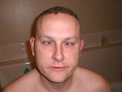 What TJ would look like with hair.