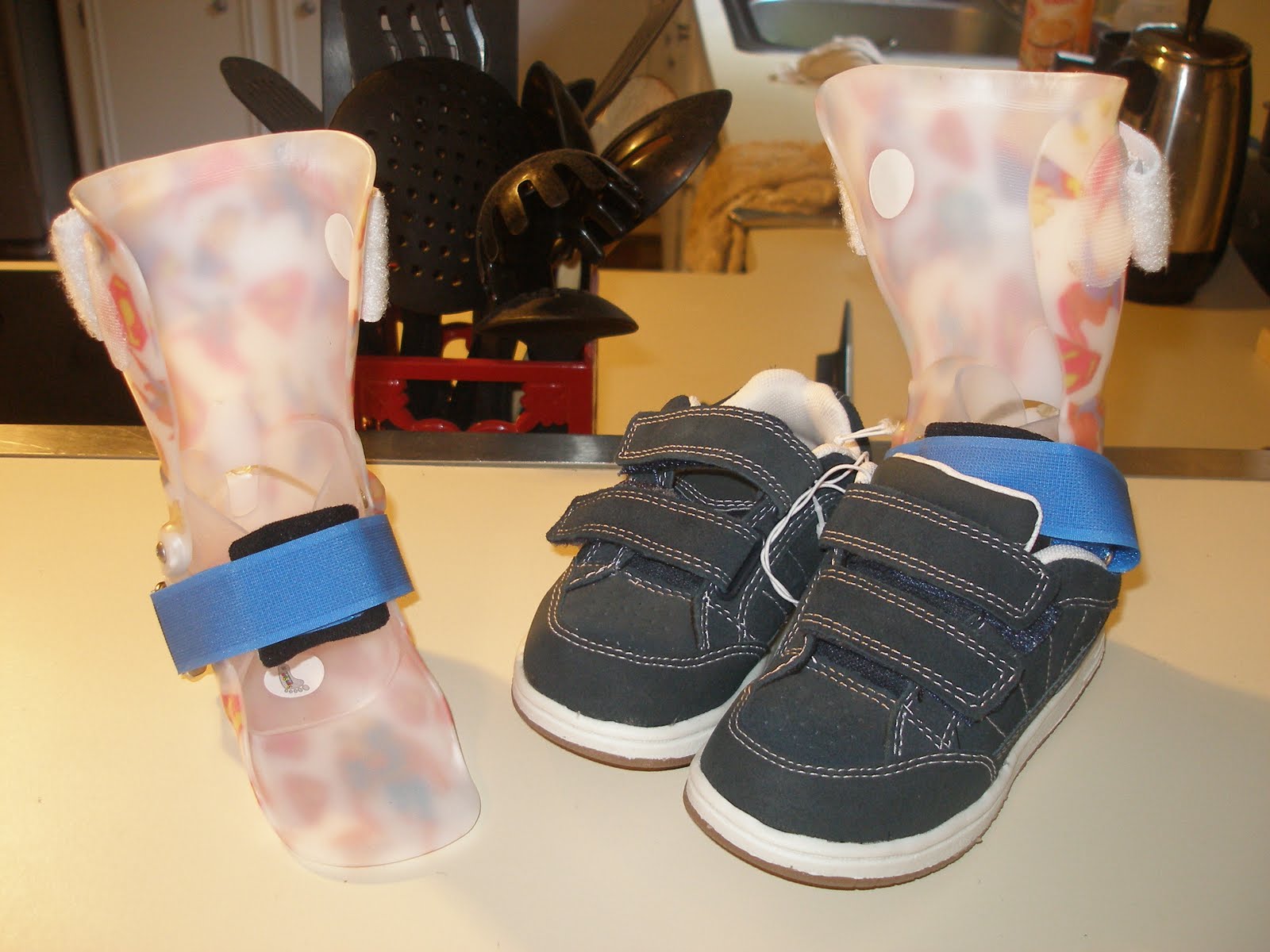 Ian’s new "braces"…SMO’s. Mommy Blogs JustMommies